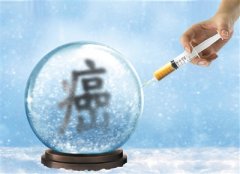 雅安恒博医院HPV检测技术，开启宫颈癌筛查新篇